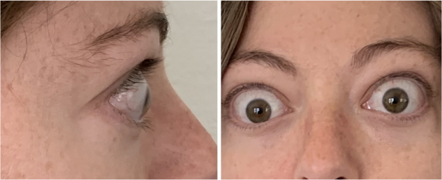 PatientResults_Slider03_Patient_01_Baseline